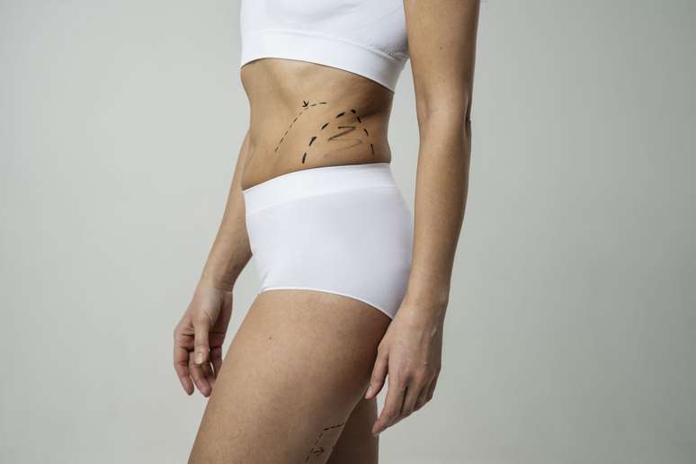 HD Lipo and Contour technologies: the future of plastic surgery