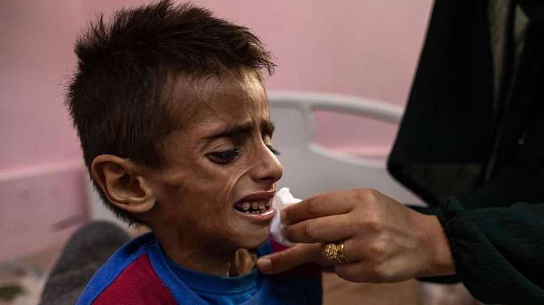 Osama al-Raqab, de 5 anos, recebendo tratamento no Hospital Nasser de Khan Younis, no sul da Faixa de Gaza