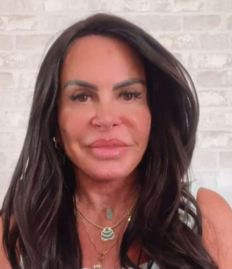 Gretchen shows “new face” after aesthetic procedures; I wait