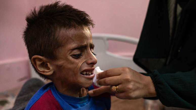 Gaza faces the “worst scenario possible of hunger”, says the Dietary Security Agency linked to the United Nations