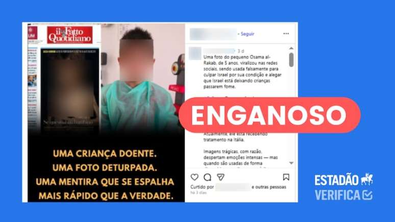 Israel desinforma ao atribuir desnutrição de criança de Gaza apenas à doença genética