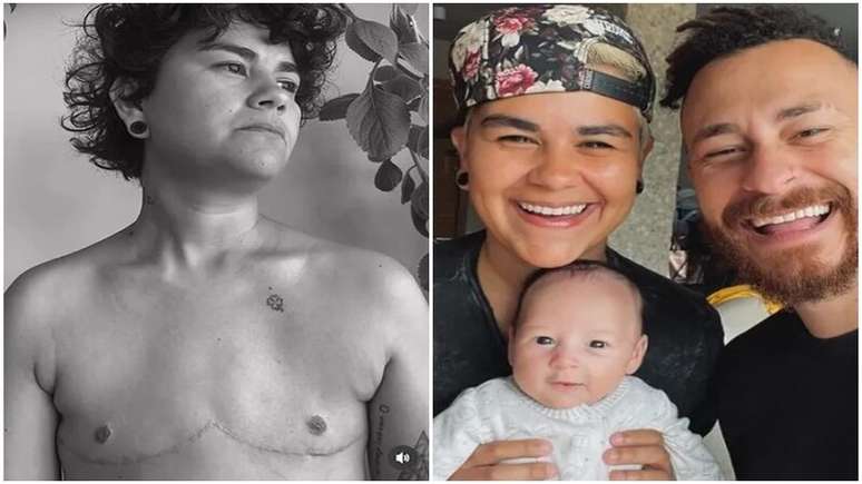 Fred Bruno’s non -binary trans brother places without a shirt after the intervention; I wait