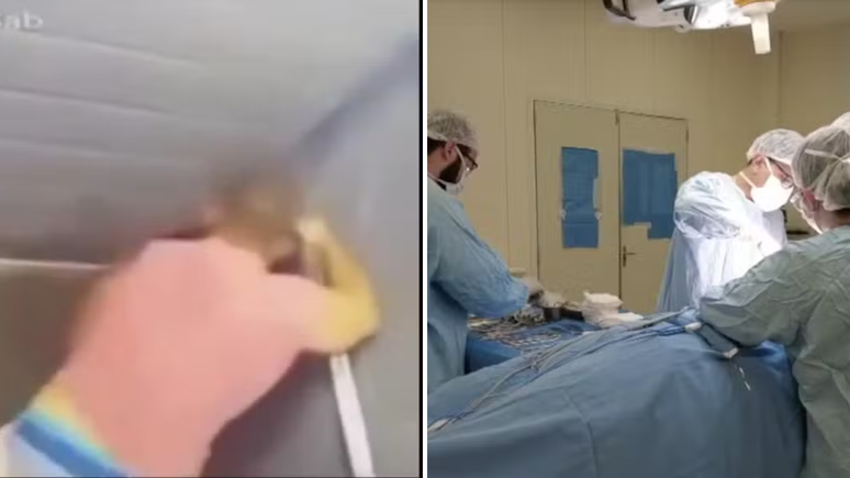 Mulher espancada pelo namorado com mais de 60 socos deve ficar com sequelas, diz dentista