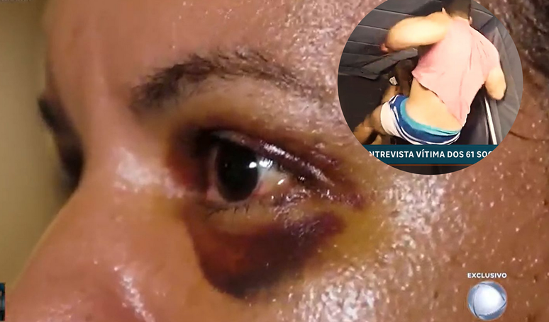 Juliana Garcia falou sobre a agressão que sofreu do então namorado, dentro do elevador de seu prédio.