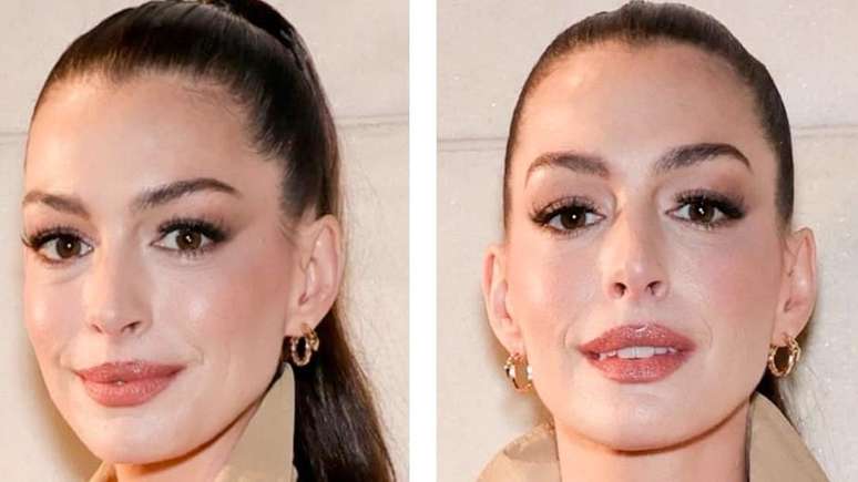 If Anne Hathaway: is it possible to have plastic surgery without anyone noticing it?