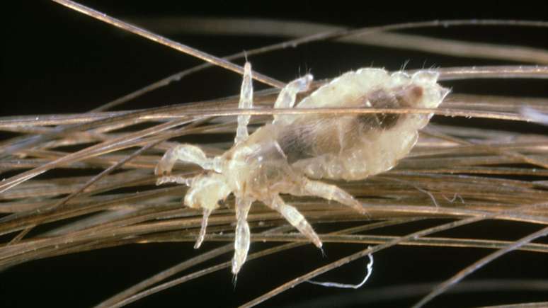 Uma fêmea adulta pode gerar centenas de piolhos em um mês