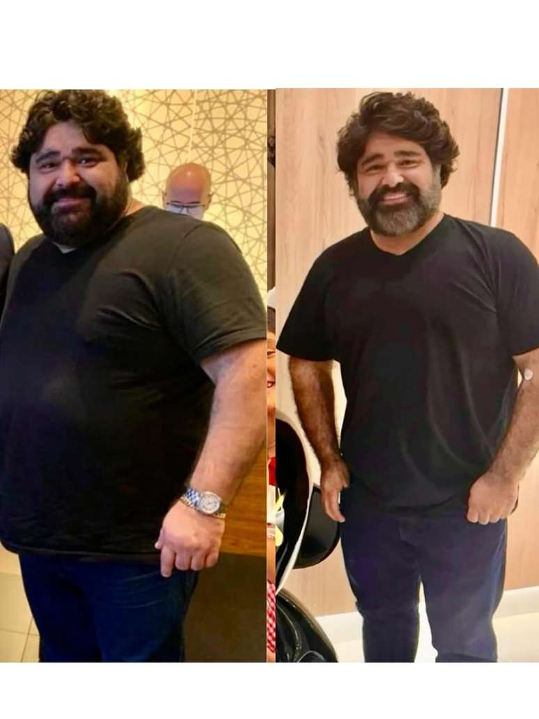 Fabiano Menotti mostra antes e depois após perder 52 kg