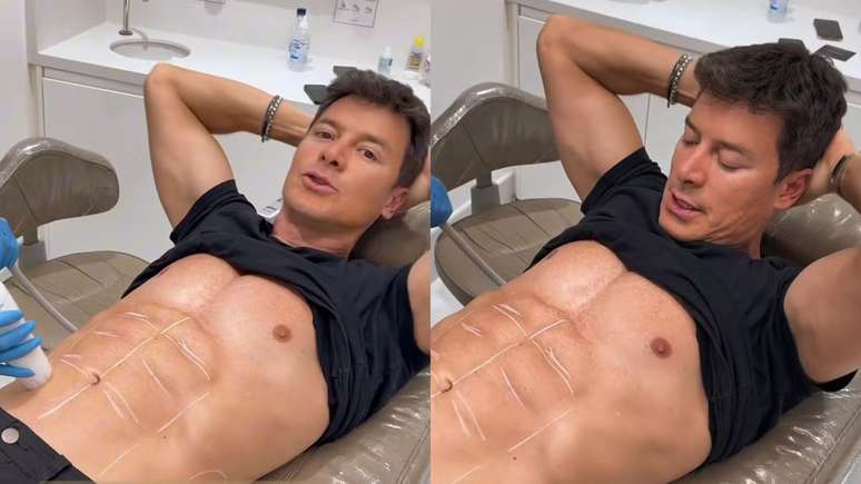 Rodrigo Faro exibiu um procedimento que realizou para perder gordura na barriga