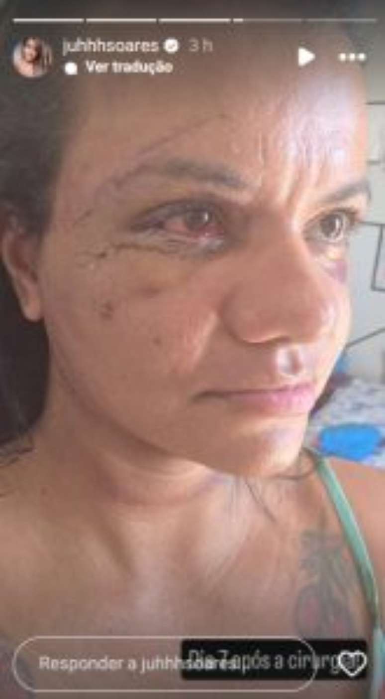 V&iacute;tima dos 60 socos