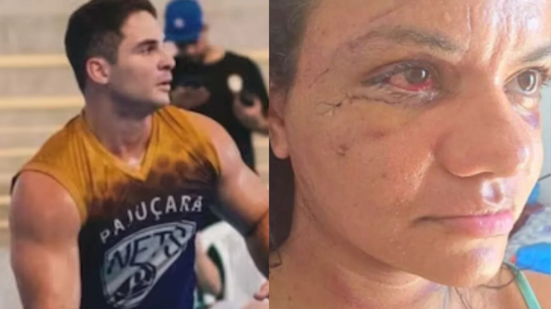 Advogada explica os detalhes do caso do homem que deu 60 socos na namorada