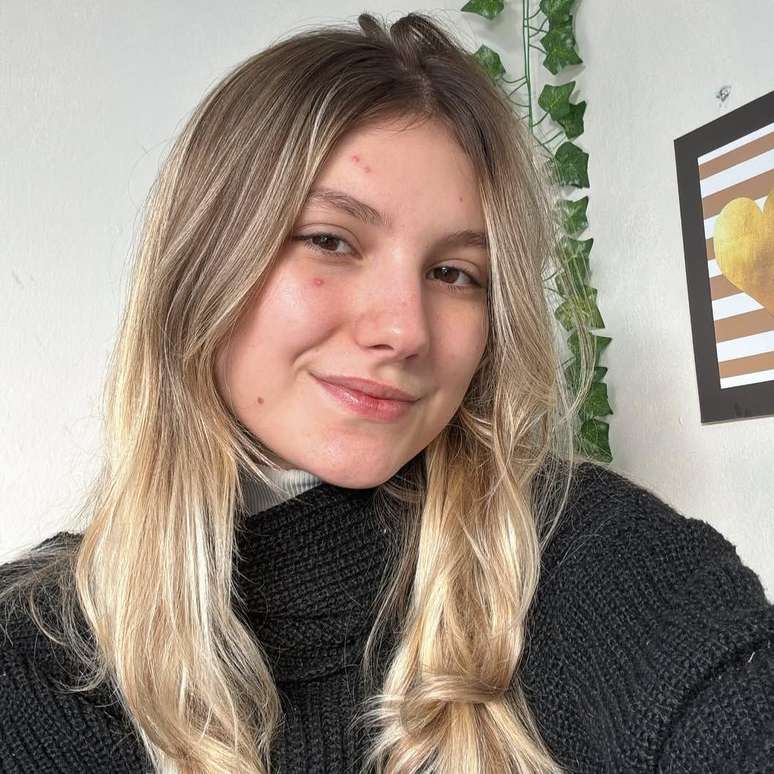 Veloso usa as redes sociais para documentar seu tratamento contra um linfoma de Hodgkin