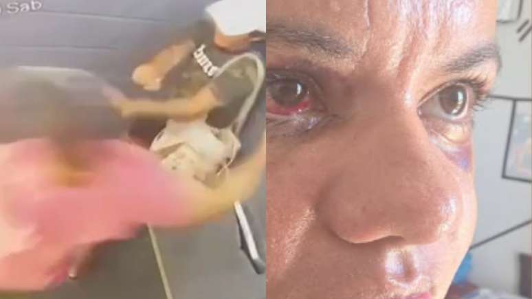 Cirurgia da v&iacute;tima dos 60 socos