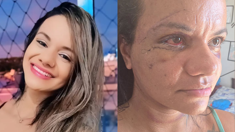 Juliana Garcia foi espancada pelo ex-jogador de basquete Igor Eduardo Pereira Cabral