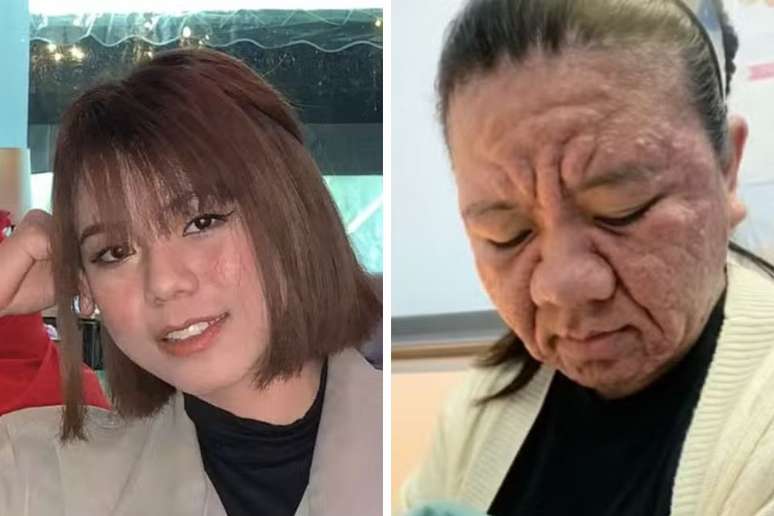 The silly woman showing how pregnancy made her face almost unrecognizable