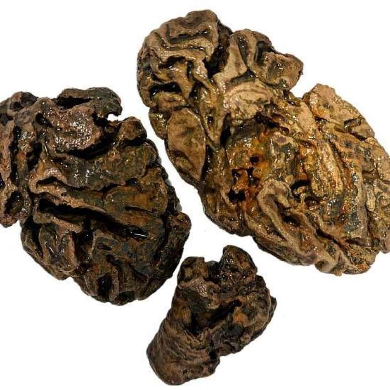 Fragmentos de c&eacute;rebro de um indiv&iacute;duo enterrado no Reino Unido h&aacute; quase 200 anos. Nenhum outro tecido mole foi encontrado no esqueleto