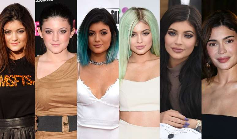 Before and after Kylie Jenner: in 65 photos, see the evolution of the beauty of the influencer after the fame and all about your aesthetic journey