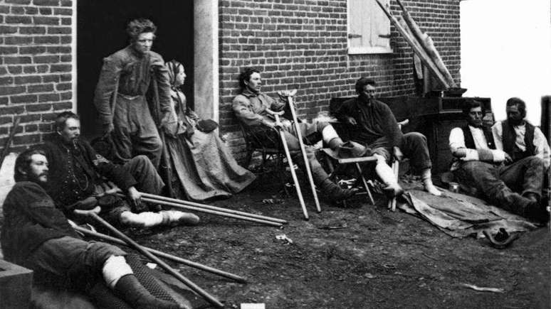 A Guerra Civil deixou milhares de feridos e mutilados, embora v&aacute;rias das 'leis da feiura' tenham exclu&iacute;do esses veteranos de suas disposi&ccedil;&otilde;es.