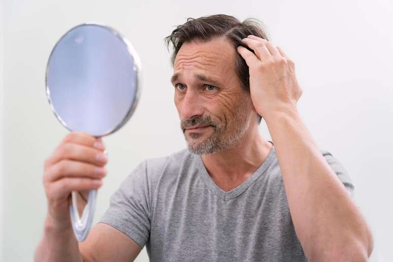 At what age does baldness start in men? Does the use of the hood causes hair loss?
