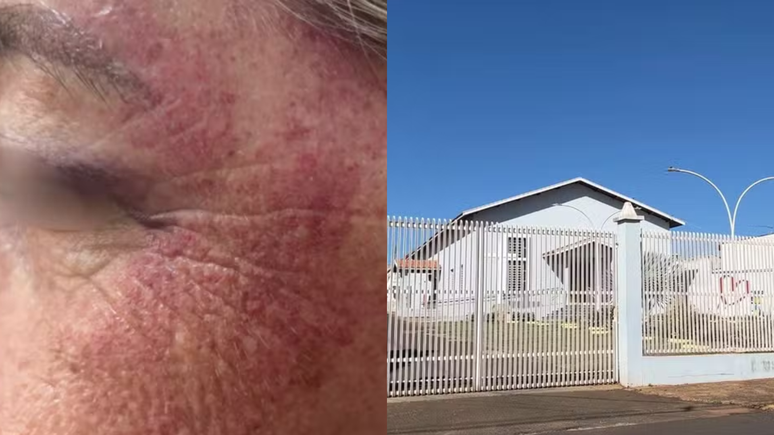 Horror in the Church: Father is accused of having attacked the woman with punches and kicks during exorcism Horror in the Church: Father is accused of having attacked the woman with punches and kicks during exorcism