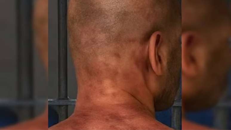 Veja as imagens do ex-jogador agredido ap&oacute;s tentar matar a ex