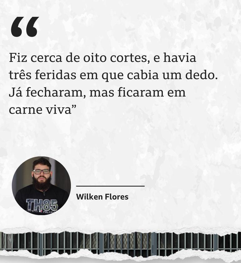 Foto de Wilken Flores com a seguinte aspa: 'Fiz cerca de oito cortes, e havia tr&ecirc;s feridas em que cabia um dedo. J&aacute; fecharam, mas ficaram em carne viva'