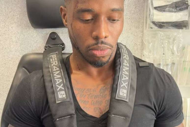 Influenciadores mostraram ferimentos ap&oacute;s serem atingidos por carro dentro de restaurante