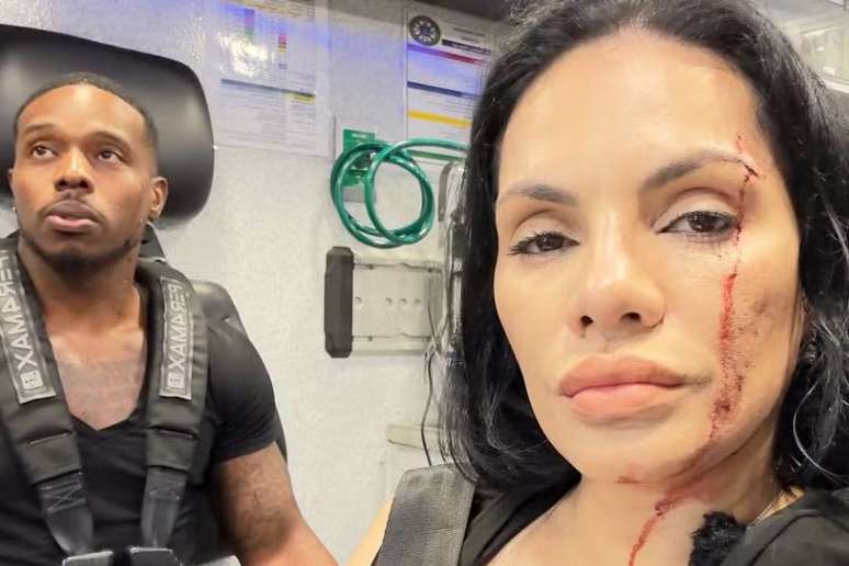 Influenciadores mostraram ferimentos ap&oacute;s serem atingidos por carro dentro de restaurante