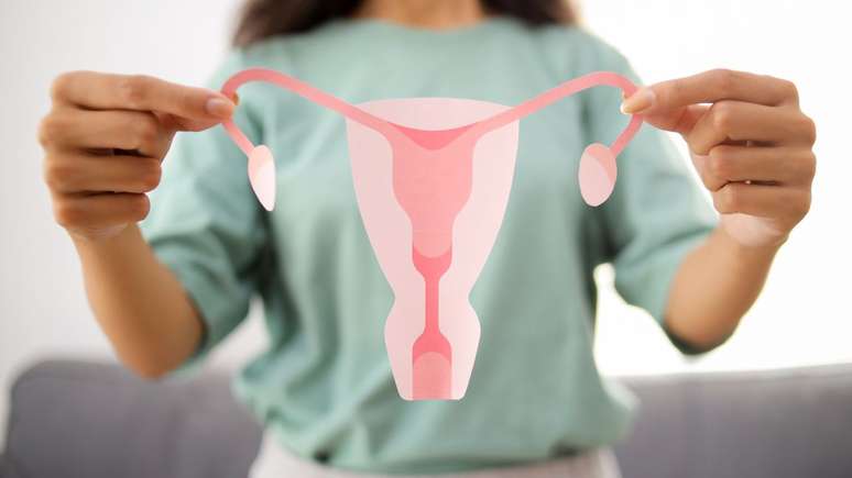 Endometriosis: the symptoms of the disease that may take years to be diagnosed