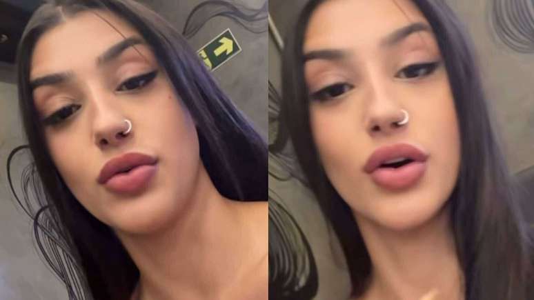Bia Miranda surprises showing an injury after an accident: “He is burning a lot” Bia Miranda surprises showing an injury after an accident: “He is burning a lot”