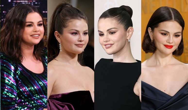 Before and after Selena Gomez in 40 photos: Plastic Surgeon Points Rhinoplasty, lifting and more procedures, but the singer has admitted only one to date