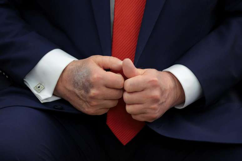 Roxos in the hand of Trump: what is known about the health of the President of the United States