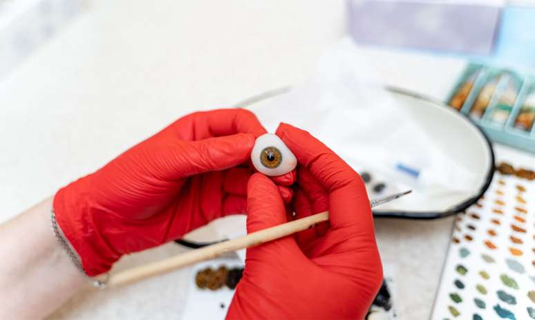 Corneal transplant: how does surgery occur and how is vision?
