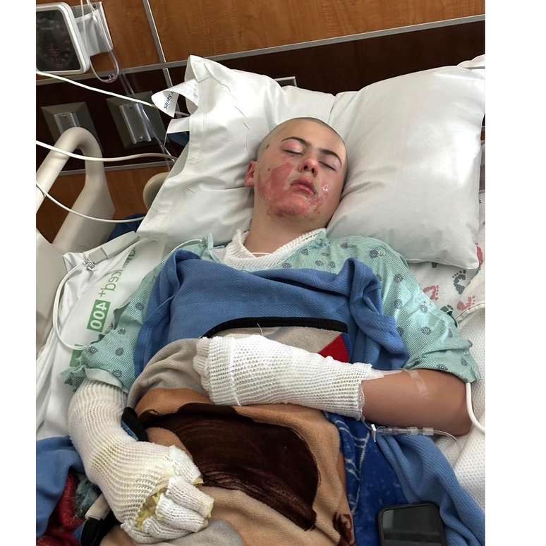 Caden Ballard em recuperação no hospital