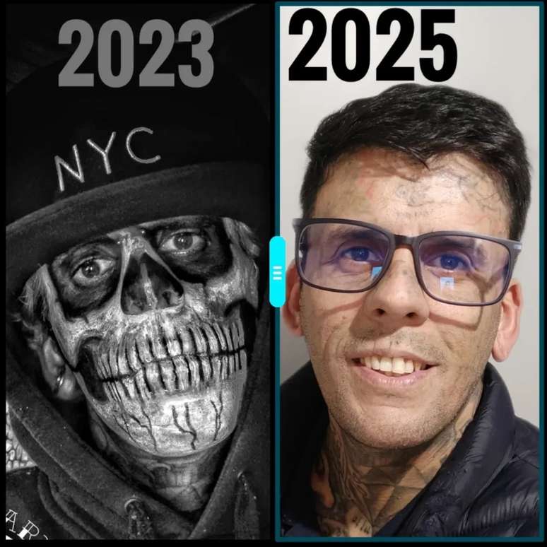 Leandro de Souza mostra mudan&ccedil;as f&iacute;sicas ap&oacute;s in&iacute;cio das remo&ccedil;&otilde;es de tatuagem