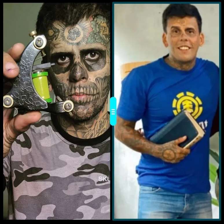 Leandro de Souza mostra mudan&ccedil;as f&iacute;sicas ap&oacute;s in&iacute;cio das remo&ccedil;&otilde;es de tatuagem
