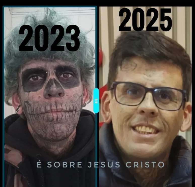 Leandro de Souza mostra mudan&ccedil;as f&iacute;sicas ap&oacute;s in&iacute;cio das remo&ccedil;&otilde;es de tatuagem