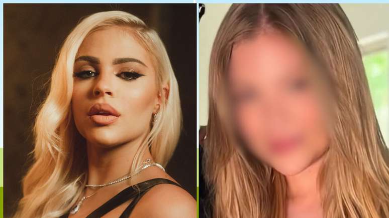 Lu&iacute;sa Sonza pode ter reduzido o preenchimento labial e f&atilde;s apontam rejuvenescimento. Especialista explica como o procedimento &eacute; feito e os efeitos na harmonia do rosto