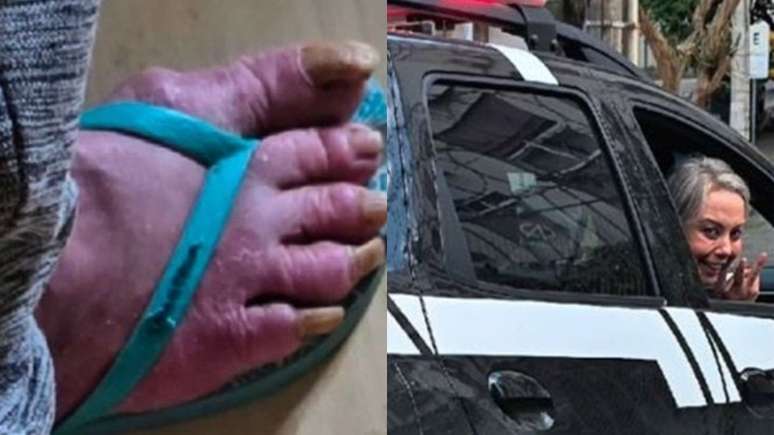 The former actress Globo is located in a precarious and dirty place; Take a look at the state