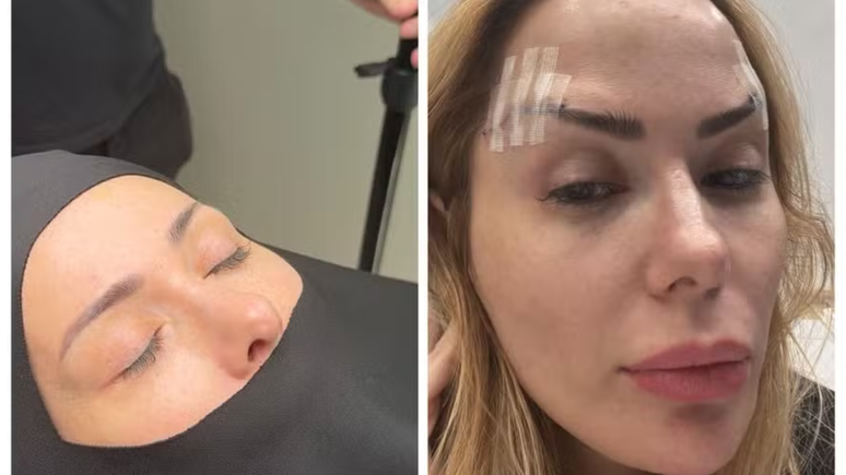 Influenciadora faz sua 50ª cirurgia plástica: 'É uma cirurgia delicada' / Reprodução: Instagram