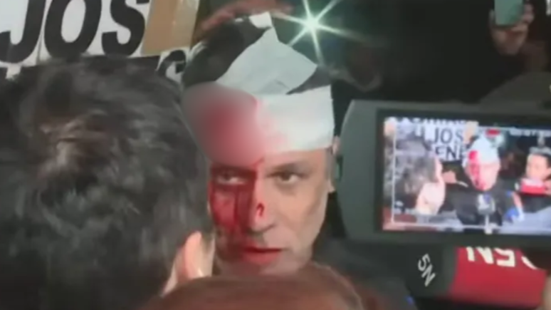 The journalist is seriously injured at an event by Milei
