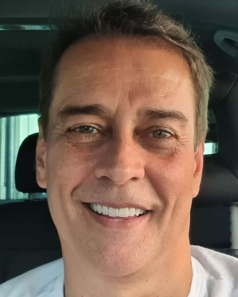 Marcello Antony, ator e corretor de im&oacute;veis, fez o transplante capilar e aprovou o resultado