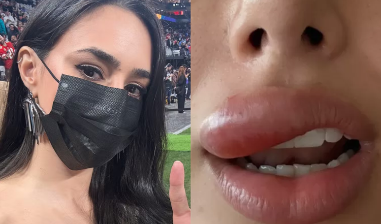 The doctors explain the problem of health that blocks Brunette Bianincardi’s mouth: “It can evolve into a meningitis or other bigger complications” The doctors explain the problem of health that blocks Brunette Bianincardi’s mouth: “It can evolve into a meningitis or other bigger complications”