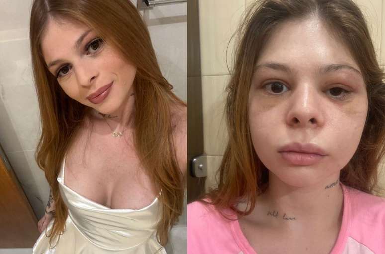 M&eacute;dica antes e depois da agress&atilde;o 