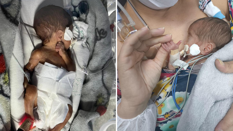 (left) Henry with 15 days and (right) with 28 days, the first time on the womb to the mother