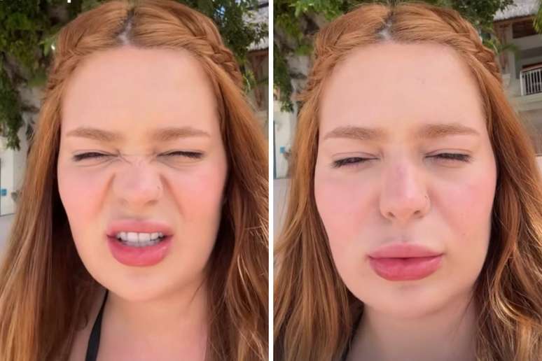 VIIH TUBE replaces the results of Botox to 25: “strange thing”