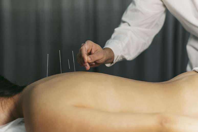 How acupuncture deals with the symptoms related to stress