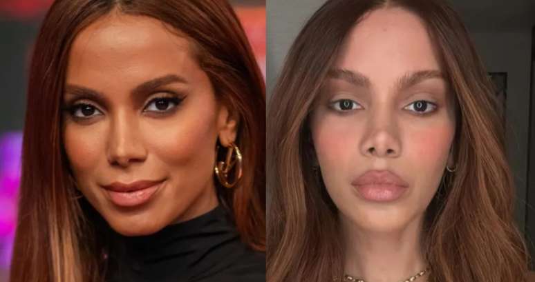 Anitta em 2024 e agora, repaginada: imprensa e fãs já perderam a conta de quantas plásticas a cantora fez