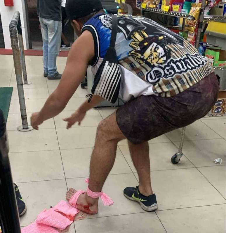 Torcedor do Vasco sangrando no p&eacute; ap&oacute;s levar tiro em briga &ndash;