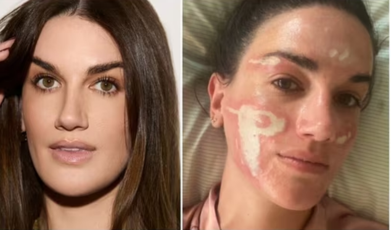 ‘Very traumatic experience’: the woman accuses Madonna’s beautician, Kim Kardashian and the most famous of serious face burning after chemical peeling