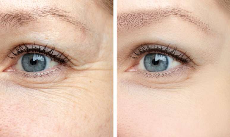 Learn to avoid wrinkles and other problems in the eye region